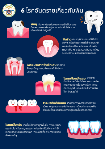 6 โรคอันตรายสุขภาพในช่องปาก